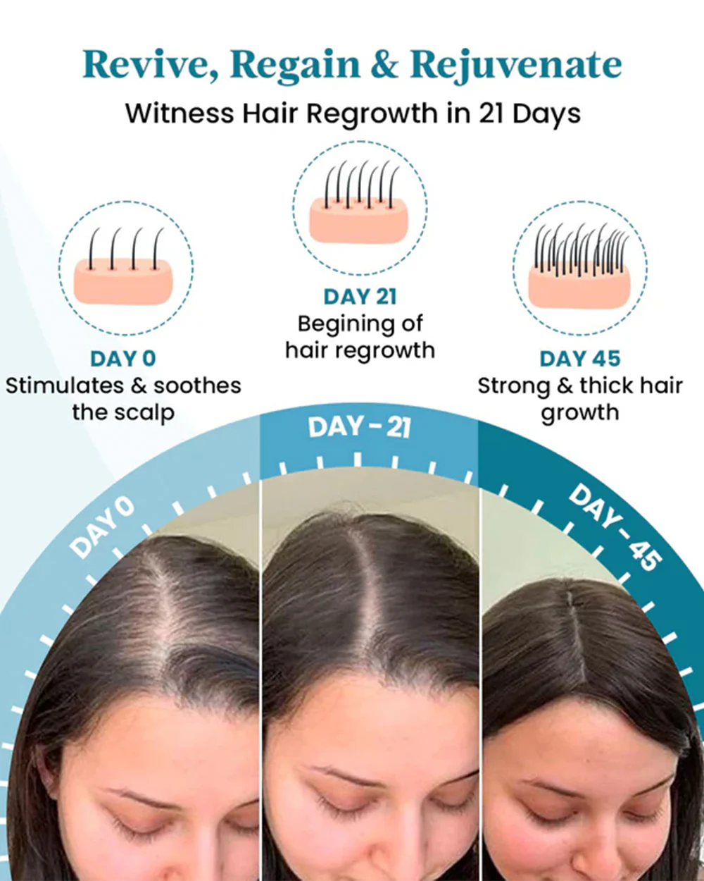 Healofy Naturals Root Revive Hair Tonic-Hair Regrowth-During & After Pregnancy - Image 3