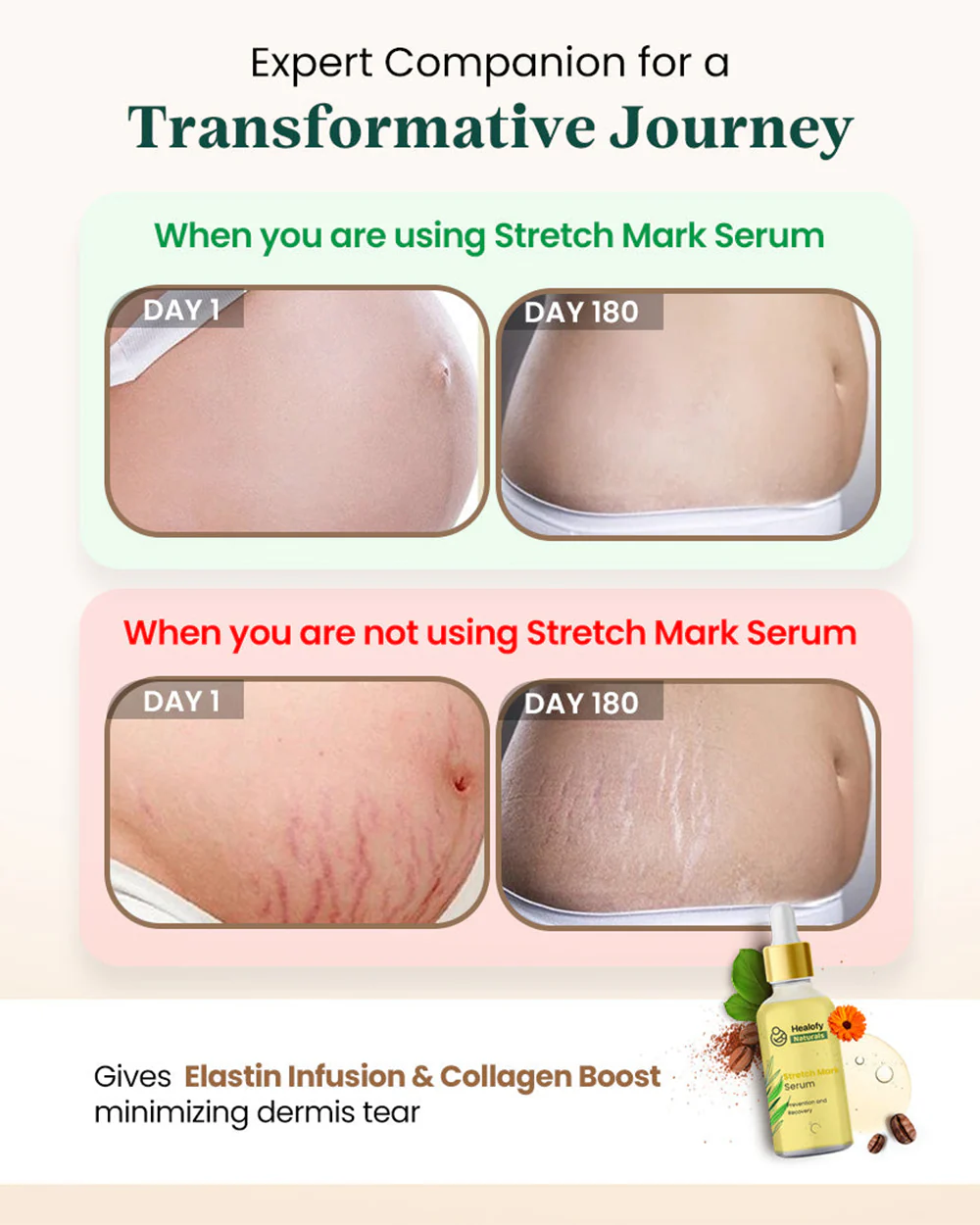 Healofy Naturals Stretch Marks Serum-Pregnancy & Breastfeeding Safe - Image 5